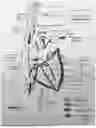 Fig. 02 - RETROGRADE CORONARY VENOUS OR SINUS ADMINISTRATION OF THERAPEUTICS