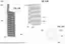 Fig. 09 - VACUUM BASED SYSTEM AND METHOD FOR TREATING A GASTROINTESTINAL TRACT OF A SUBJECT
