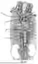 Fig. 03 - SYSTEMS AND METHODS FOR SELECTIVELY OCCLUDING THE SUPERIOR VENA CAVA FOR TREATING HEART CONDITIONS