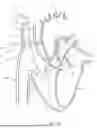 Fig. 56 - SYSTEMS AND METHODS FOR SELECTIVELY OCCLUDING THE SUPERIOR VENA CAVA FOR TREATING HEART CONDITIONS
