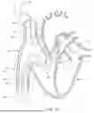 Fig. 57 - SYSTEMS AND METHODS FOR SELECTIVELY OCCLUDING THE SUPERIOR VENA CAVA FOR TREATING HEART CONDITIONS