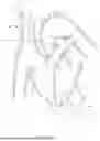 Fig. 59 - SYSTEMS AND METHODS FOR SELECTIVELY OCCLUDING THE SUPERIOR VENA CAVA FOR TREATING HEART CONDITIONS