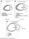 Fig. 62 - SYSTEMS AND METHODS FOR SELECTIVELY OCCLUDING THE SUPERIOR VENA CAVA FOR TREATING HEART CONDITIONS