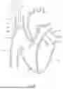 Fig. 63 - SYSTEMS AND METHODS FOR SELECTIVELY OCCLUDING THE SUPERIOR VENA CAVA FOR TREATING HEART CONDITIONS