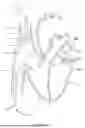 Fig. 66 - SYSTEMS AND METHODS FOR SELECTIVELY OCCLUDING THE SUPERIOR VENA CAVA FOR TREATING HEART CONDITIONS