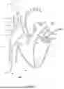 Fig. 67 - SYSTEMS AND METHODS FOR SELECTIVELY OCCLUDING THE SUPERIOR VENA CAVA FOR TREATING HEART CONDITIONS