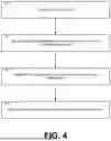 Fig. 04 - SUBCUTANEOUS PHOTOBIOMODULATION