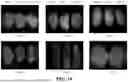 Fig. 20 - ENGINEERED ADENO-ASSOCIATED VIRUS CAPSIDS