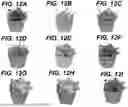 Fig. 13 - VISUAL GUIDED MESH REPAIR