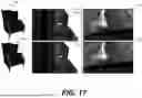 Fig. 19 - VISUAL GUIDED MESH REPAIR