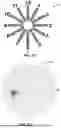 Fig. 08 - METHODS AND SYSTEMS FOR EVALUATING VISION DURING DIGITAL DEVICE USE AND BLUE LIGHT SENSITIVITY USING VIRTUAL REALITY