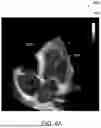 Fig. 07 - SYSTEM FOR CATHETER-GUIDED VISUALIZATION AND RENDERING
