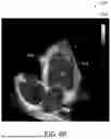 Fig. 08 - SYSTEM FOR CATHETER-GUIDED VISUALIZATION AND RENDERING