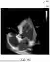 Fig. 09 - SYSTEM FOR CATHETER-GUIDED VISUALIZATION AND RENDERING