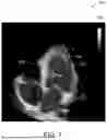 Fig. 11 - SYSTEM FOR CATHETER-GUIDED VISUALIZATION AND RENDERING
