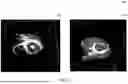 Fig. 13 - SYSTEM FOR CATHETER-GUIDED VISUALIZATION AND RENDERING