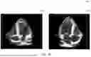 Fig. 14 - SYSTEM FOR CATHETER-GUIDED VISUALIZATION AND RENDERING