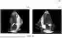 Fig. 15 - SYSTEM FOR CATHETER-GUIDED VISUALIZATION AND RENDERING