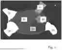 Fig. 02 - LEFT ATRIAL APPENDAGE CLOSURE DEVICE SPECIFICATION FROM 2D ICE TO TREAT ATRIAL FIBRILLATION PATIENTS