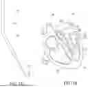 Fig. 02 - ECHOCARDIOGRAM UNIT FOR MECHANICAL ASSIST DEVICES