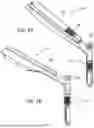 Fig. 02 - COMPRESSION/NEUTRAL DRILL GUIDE SLEEVE