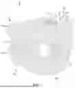 Fig. 02 - ORAL TRAUMA STABILIZER DEVICE