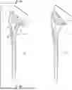 Fig. 01 - CONVERTIBLE STEM/FRACTURE STEM