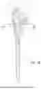 Fig. 06 - CONVERTIBLE STEM/FRACTURE STEM