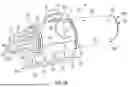 Fig. 05 - CATHETER SYSTEMS AND HANDLES