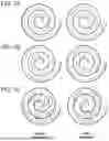 Fig. 03 - WEARABLE DEVICES FOR VIBRATORY STIMULATION TO REDUCE TREMOR