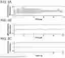 Fig. 04 - WEARABLE DEVICES FOR VIBRATORY STIMULATION TO REDUCE TREMOR
