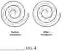 Fig. 05 - WEARABLE DEVICES FOR VIBRATORY STIMULATION TO REDUCE TREMOR