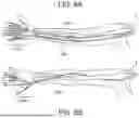 Fig. 07 - WEARABLE DEVICES FOR VIBRATORY STIMULATION TO REDUCE TREMOR