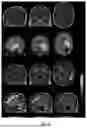 Fig. 07 - METHODS AND SYSTEMS FOR RESTING STATE FMRI BRAIN MAPPING WITH REDUCED IMAGING TIME