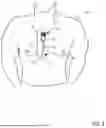 Fig. 02 - ELECTROCARDIOGRAM ANALOG FRONT END