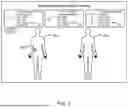 Fig. 08 - MEDICAL IMPLANT TRACKING SYSTEM