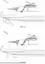 Fig. 06 - DEVICE FOR INJECTING A SUBSTANCE INTO AN INTERLAYER OF A BODY TISSUE OR ORGAN