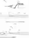 Fig. 07 - DEVICE FOR INJECTING A SUBSTANCE INTO AN INTERLAYER OF A BODY TISSUE OR ORGAN