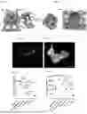 Fig. 02 - ACTIVATION AND PROLIFERATION OF CYTOTOXIC LYMPHOCYTES