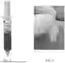 Fig. 05 - PSILOCYBE ASSAY