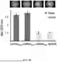 Fig. 09 - UNIVERSAL PAPER-BASED GENOME DETECTION USING A UNIVERSAL RNA TOEHOLD SWITCH AND CRISPR