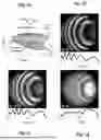 Fig. 06 - SYSTEM AND METHOD FOR IMAGE ENHANCEMENT OF REFLECTANCE CONFOCAL MICROSCOPES