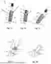 Fig. 02 - Tissue Repair System and Related Methods