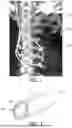 Fig. 02 - PROVIDING GUIDANCE INFORMATION FOR AN IMPLANTABLE DEVICE EXTRACTION PROCEDURE