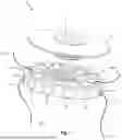 Fig. 02 - Multi-Strand Knotless Tensionable Fixation System and Related Methods