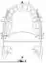Fig. 02 - BILATERAL TONGUE BASE REPOSITIONER