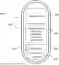 Fig. 01 - Gastrointestinal Capsule and Treatment Method
