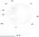 Fig. 06 - Multifunction Newborn Gavage Tube