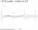 Fig. 23 - Multifunction Newborn Gavage Tube