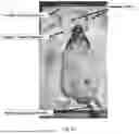 Fig. 31 - Multifunction Newborn Gavage Tube